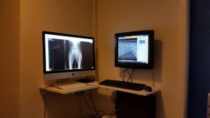 Digitale ontwikkeling röntgenfoto's